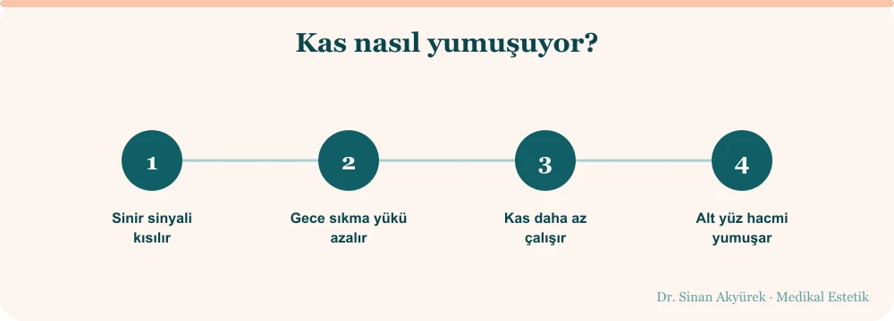Masseter botoksunda üç aşamalı süreç: sinir sinyalinin azalması, kasın dinlenmesi, alt yüzde hacim yumuşaması