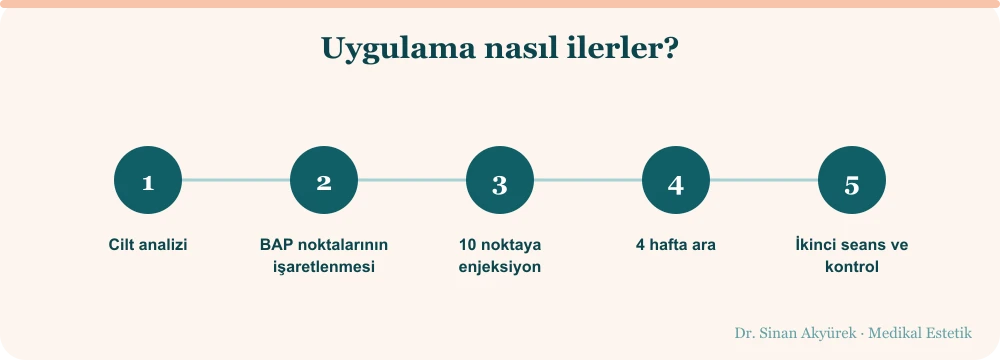 Profhilo uygulama akışı: cilt analizi, BAP noktalarının işaretlenmesi, on noktaya enjeksiyon, dört hafta ara, ikinci seans ve kontrol